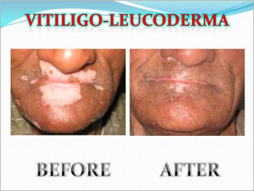 Multispeciality homeopathic clinic in Varanasi Life Homeo Care