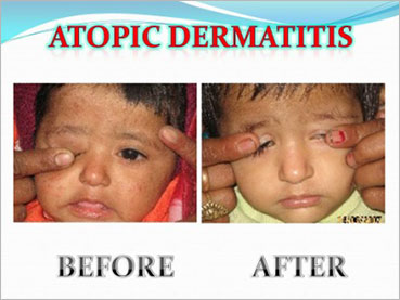 Life Homeo Care Multispeciality homeopathic clinic in Varanasi