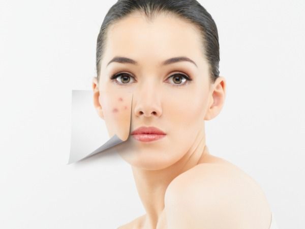 Acne-Life Homeo Care