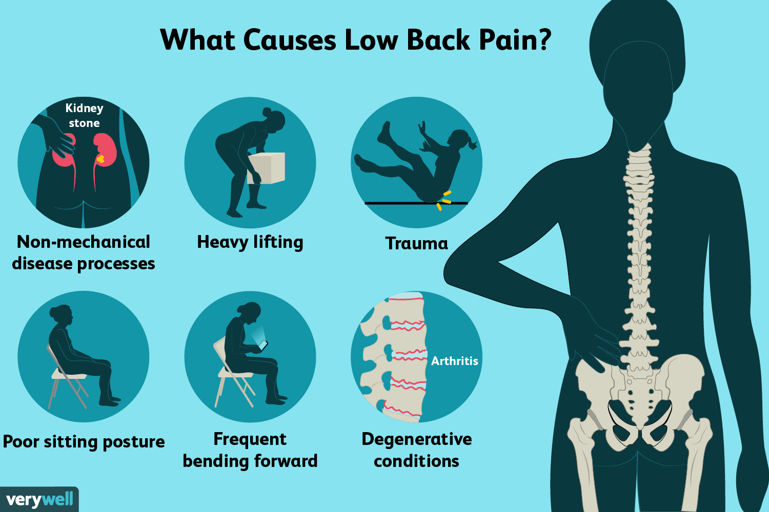 Homeopathic Medicines for Back Pain-Life Homeo Care