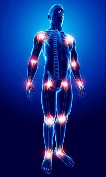 Top 10 Homeopathic Remedies for Joint Pains-Life Homeo Care